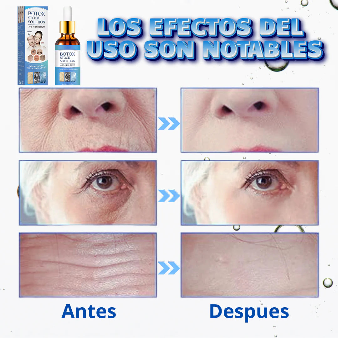 BOTOX STOCK SOLUTION / SUERO ANTIARRUGAS®