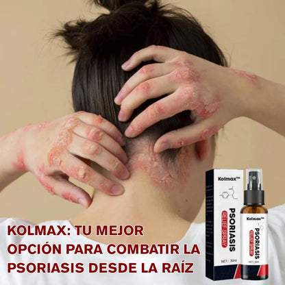 Kolmax™ 2x1 Unidades – Tratamiento en Spray para la Psoriasis✨